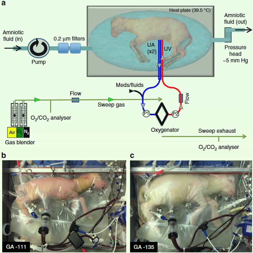 UA/UV Biobag System Design