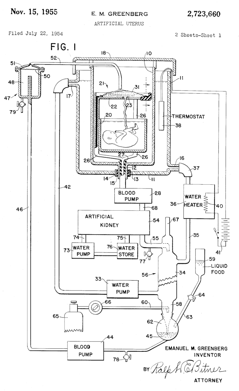 Artificial Womb Drawing Patented
